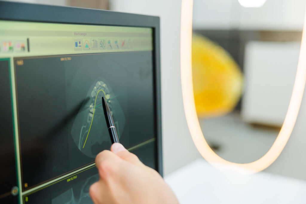 Komplettsanierung Ihrer Zähne bei den Spezialisten Dres. Nowak in Berlin.