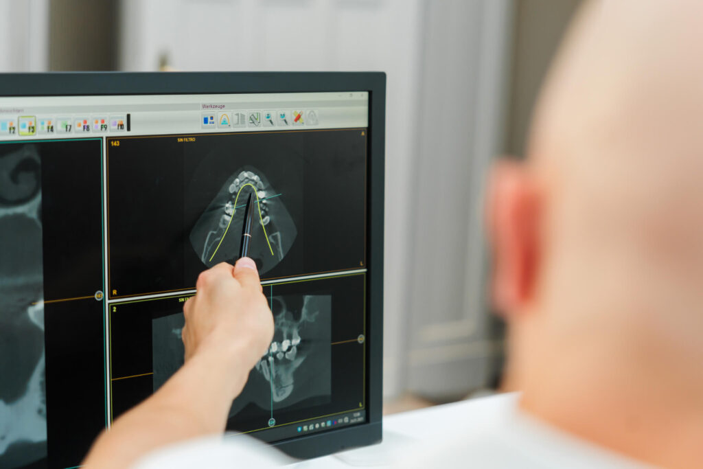Zahnarzt Dr. Nowak berät einen Patienten in Berlin zu Knochenaufbau.